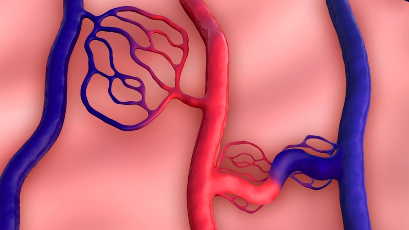 Sau điều trị dị dạng mạch máu não có tái phát không?2