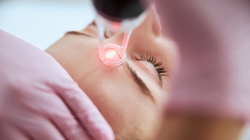 Cơ địa và khả năng tái tạo da cũng ảnh hưởng đến thời gian hết thâm sau khi bắn laser