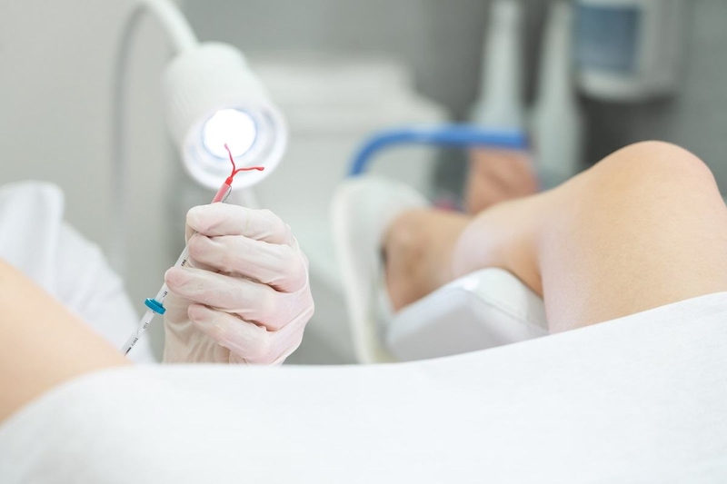 Sau khi đặt vòng tránh thai bị ra máu nhiều có bình thường không? 1