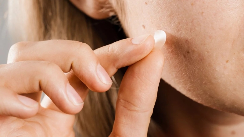 Dùng miếng dán mụn sau khi nặn mụn để bảo vệ da và giảm viêm