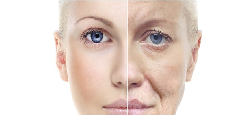 Khi nâng cung mày cần nhịn ăn từ 4 đến 6 tuần