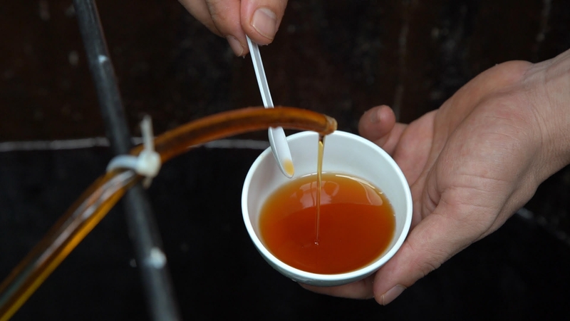 Sau khi nâng mũi ăn nước mắm được không? Những điều cần biết để phục hồi tốt nhất hậu phẫu thuật-1