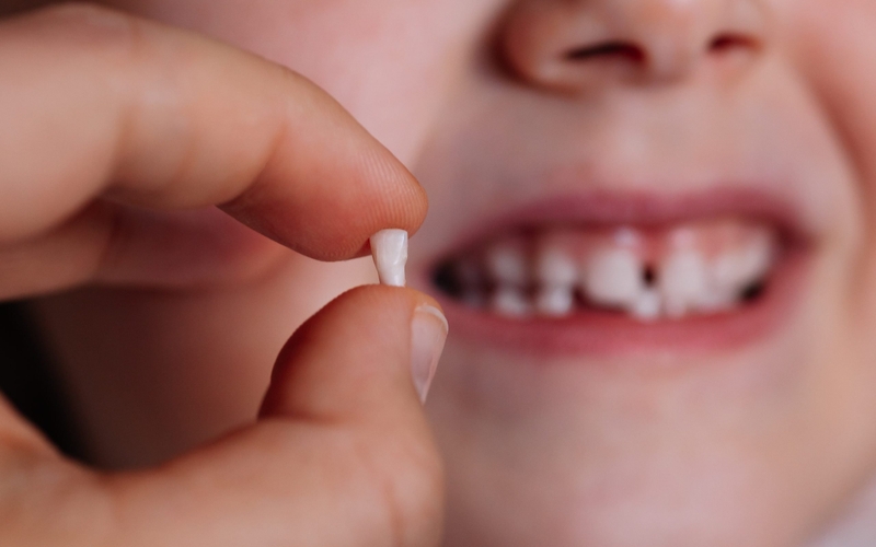 sau-khi-nho-rang-sua-vut-o-dau 2.jpg