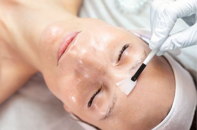 Lý giải nguyên nhân sau khi peel da bị thâm và cách khắc phục 3