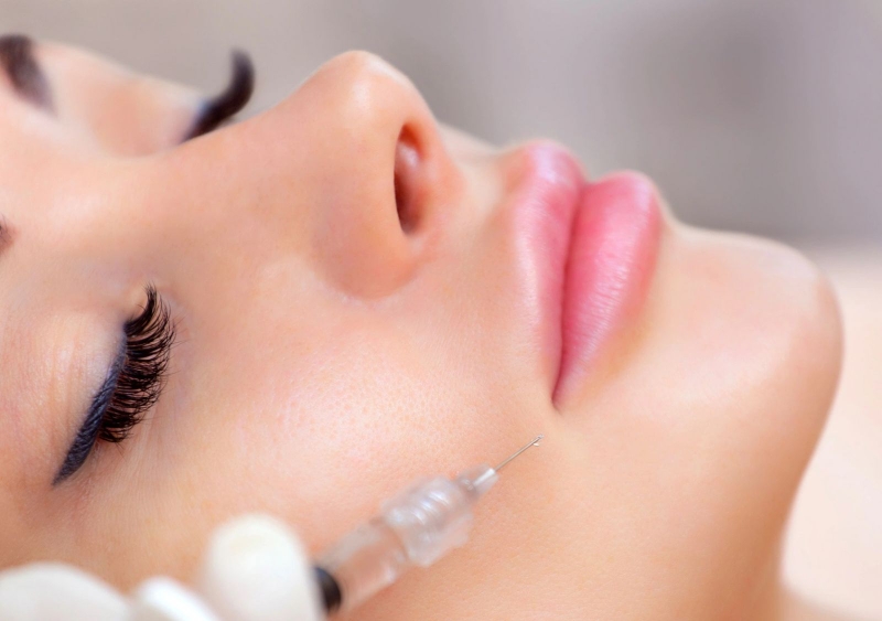 Sau khi tiêm filler má nên kiêng gì để tránh  rủi ro thẩm mỹ