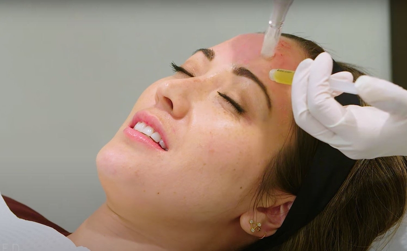 Sau làm PRP kiêng gì là tốt nhất? 1