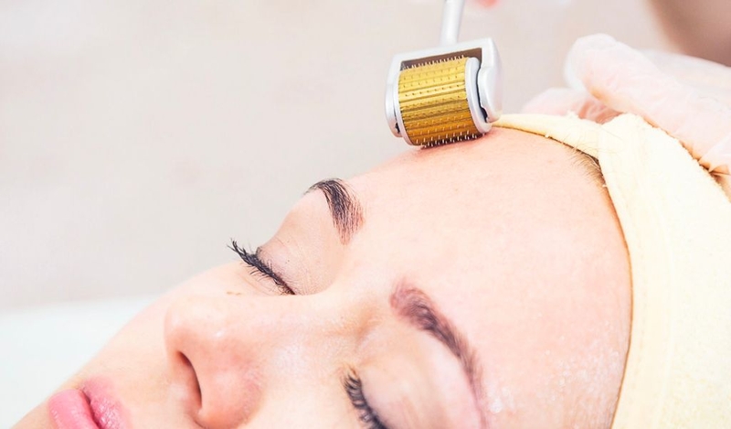 Sau lăn kim bao lâu da trở lại bình thường? Cách chăm sóc da khoa học 1