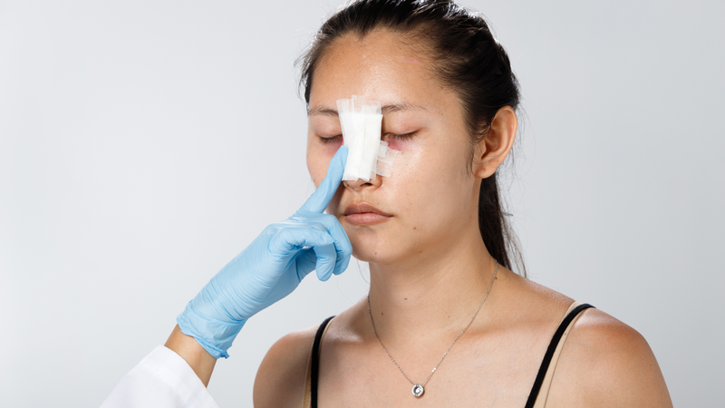 Sau nâng mũi bị chảy nước mũi do đâu? Có nguy hiểm không? 3