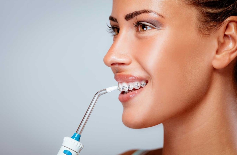 Sâu răng khi niềng răng: Cần lưu ý những điều gì? 5