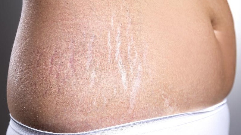 Sau sinh 1 tháng dùng kem dưỡng da được không? Những điều mẹ cần biết 1