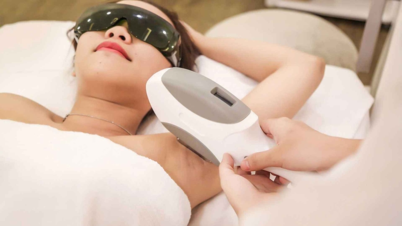 Sau triệt lông kiêng nước bao lâu? Những điều cần lưu ý sau triệt lông 4