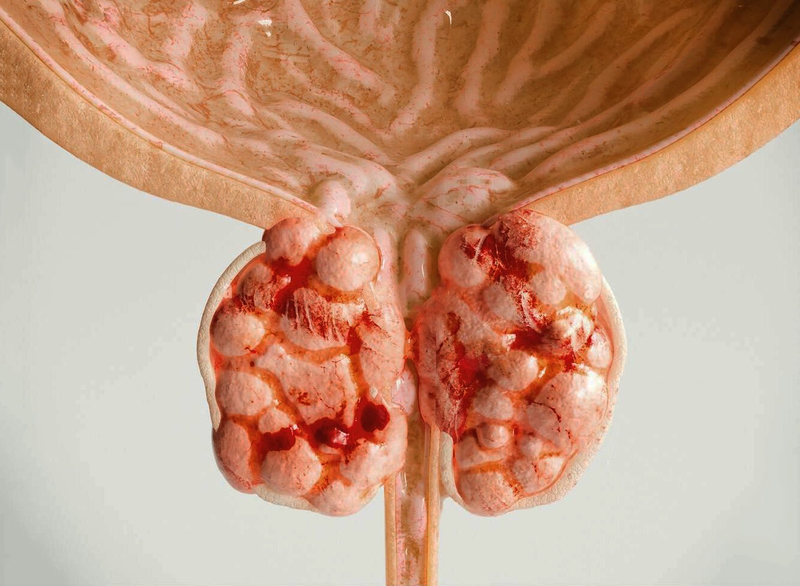 Saw Palmetto là gì? Saw Palmetto có tác dụng gì đối với sức khỏe 2