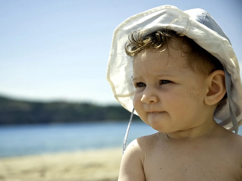 Say nắng ở trẻ là gì? Mách bạn phương pháp điều trị và phòng ngừa 1