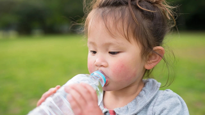 Say nắng ở trẻ là gì? Mách bạn phương pháp điều trị và phòng ngừa 3