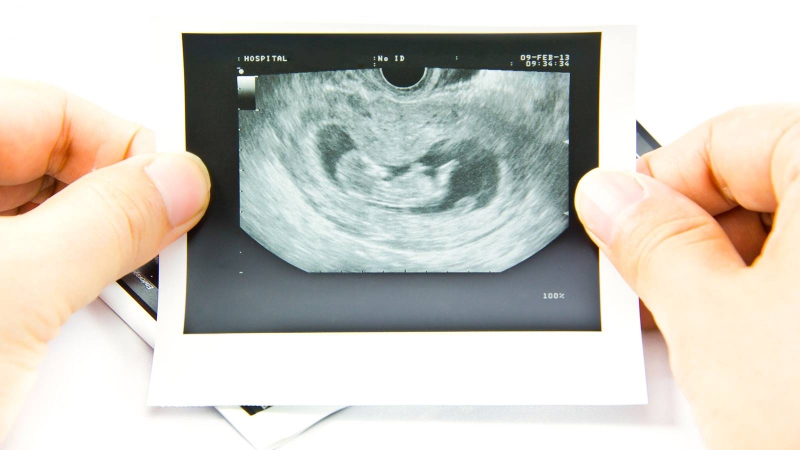 Sảy thai tự nhiên: Các dấu hiệu nhận biết theo tuần thai kỳ 1