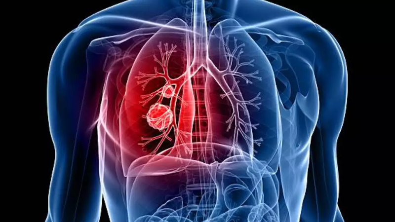 Scanneuron uống trước hay sau ăn? Những điều cần biết 4