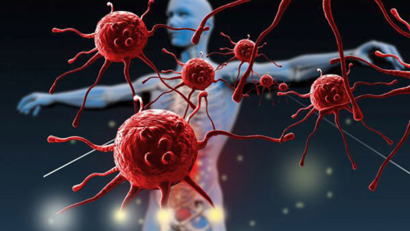 SCID là gì? Tìm hiểu nguyên nhân, triệu chứng và phương pháp điều trị 1