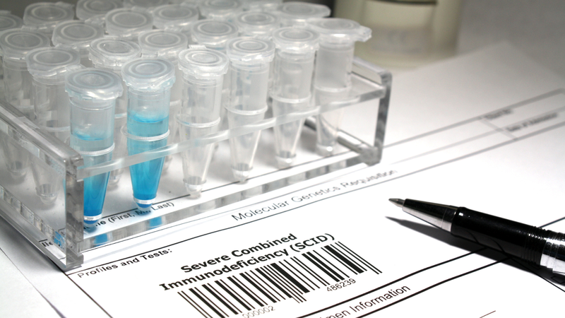 SCID là gì? Tìm hiểu nguyên nhân, triệu chứng và phương pháp điều trị 3