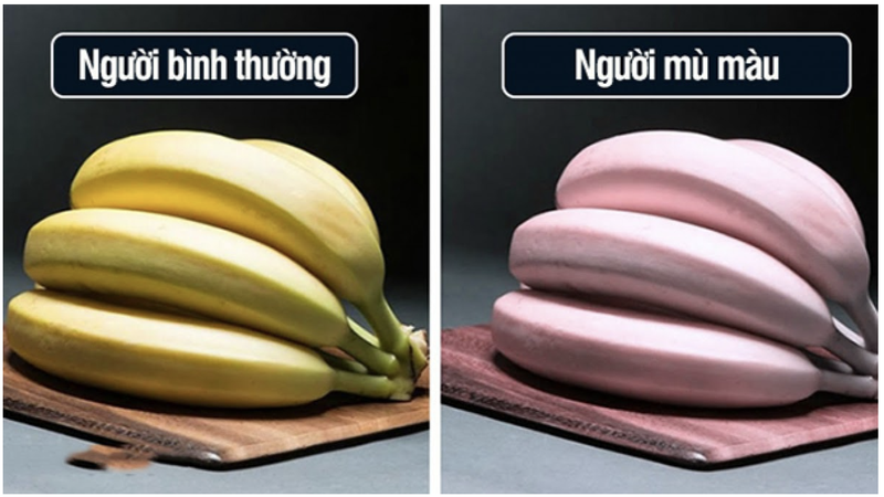 Bệnh mù màu là do đâu? Có thể chữa trị được không? 1