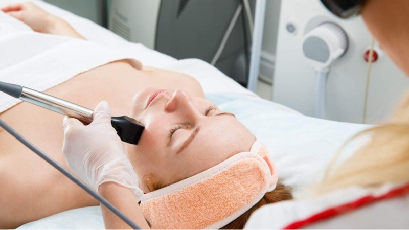 Laser CO₂ fractional hỗ trợ làm mờ sẹo hiệu quả