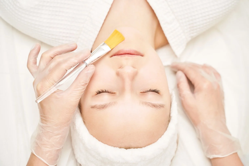 Peel là một trong những phương pháp cải thiện sẹo rỗ đáy tròn hiệu quả