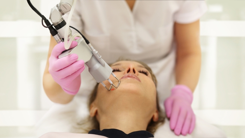 Laser là một trong những phương pháp được ứng dụng phổ biến trong điều trị sẹo rỗ đáy vuông