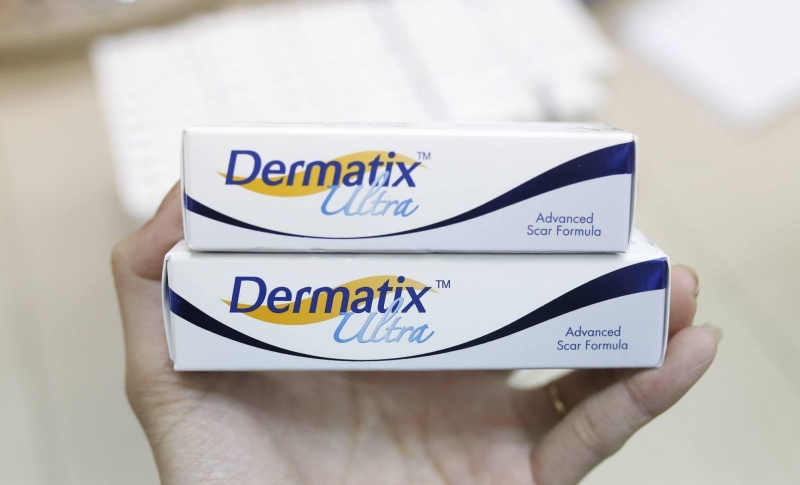 sẹo lồi có mủ 3