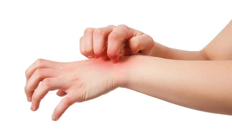 Sẹo lồi đỏ ngứa: Nguyên nhân và cách khắc phục 1