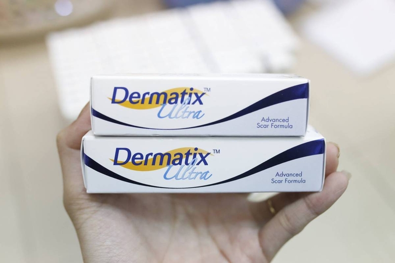 Sẹo lồi lâu năm bị ngứa điều trị như thế nào 3