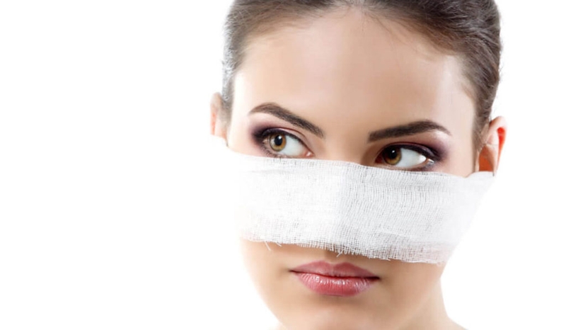 Sẹo lồi sau nâng mũi: Nguyên nhân và cách khắc phục 2