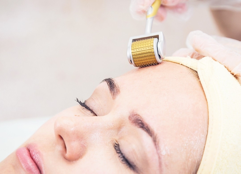 Sẹo rỗ đáy nhọn: Nguyên nhân và cách điều trị 3