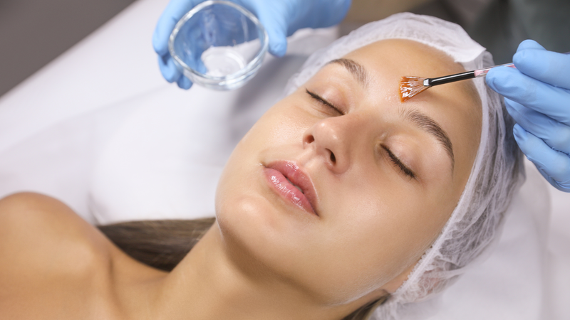 Peel da hóa học giúp hỗ trợ cải thiện bề mặt da và thúc đẩy sản sinh collagen
