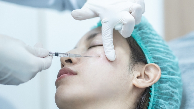 Tiêm filler nâng đáy sẹo nhanh nhưng hiệu quả giảm dần theo thời gian