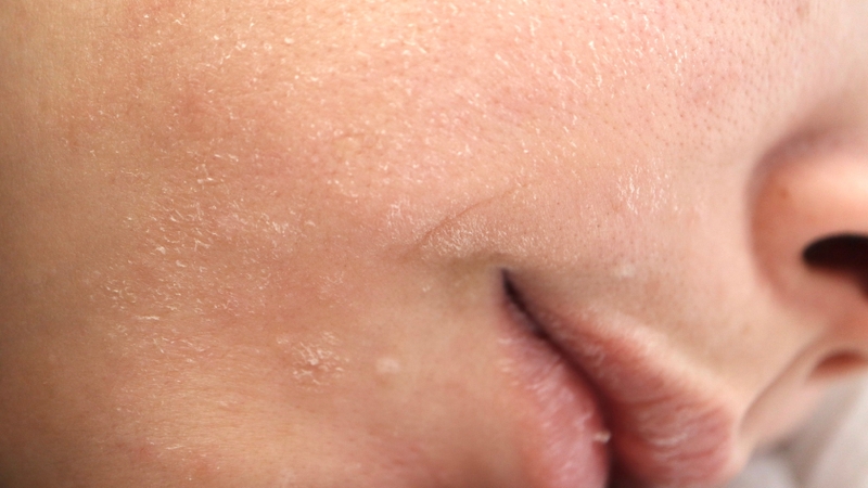 Serum phục hồi giúp bổ sung độ ẩm, hỗ trợ cải thiện cảm giác khô và duy trì độ mềm mại cho da