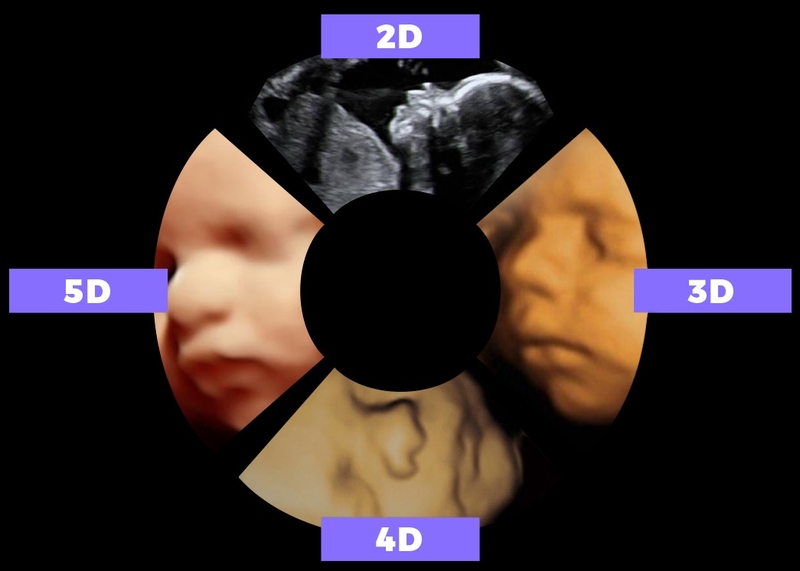 Siêu âm 5D giá bao nhiêu? 1