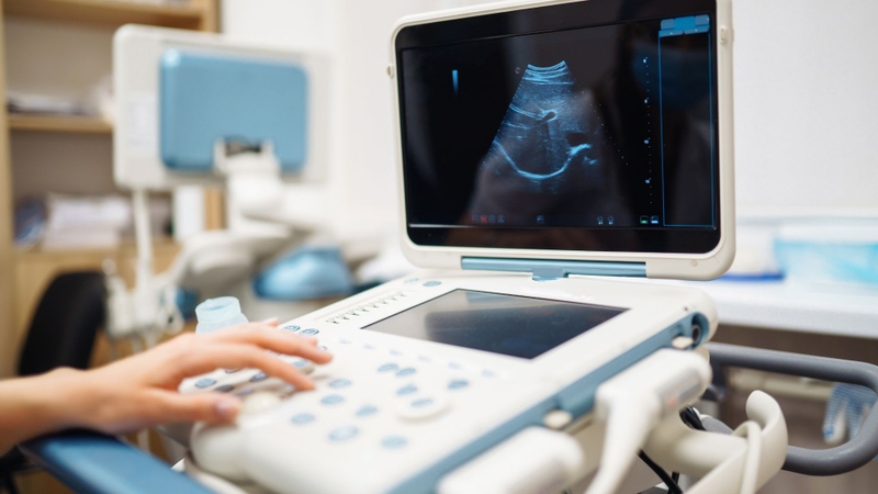 Siêu âm bơm nước buồng tử cung bị ra máu có nguy hiểm không?