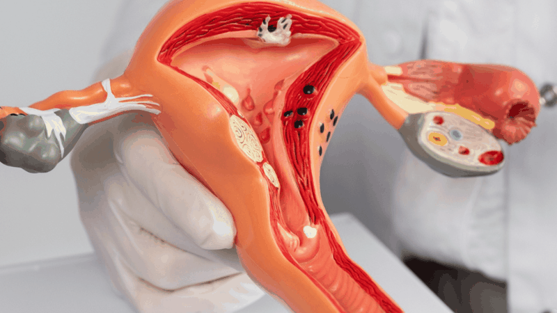 Siêu âm canh niêm mạc vào những ngày nào? Giải đáp chi tiết 3