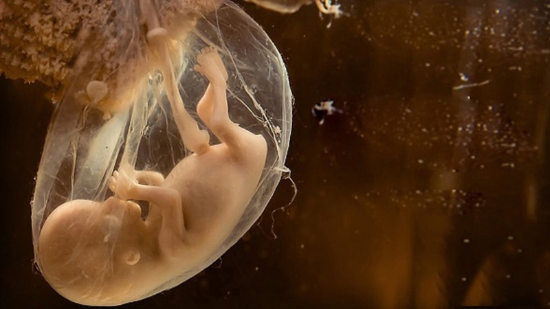 Siêu âm có biết được nước ối đục không? Khi nào nước ối đục cảnh báo nguy hiểm? 4