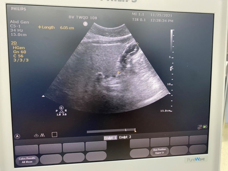 Phương pháp siêu âm dạ dày&nbsp;đơn giản, dễ thực hiện, an toàn, cho kết quả nhanh