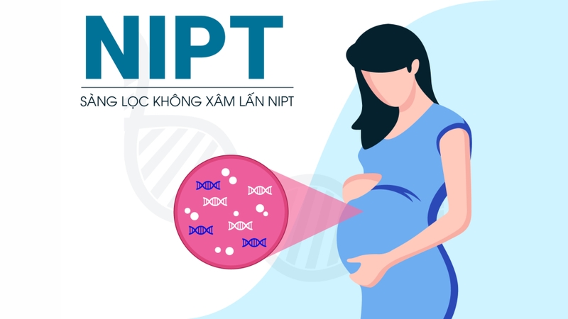 Siêu âm độ mờ da gáy và những thông tin bạn cần biết 5