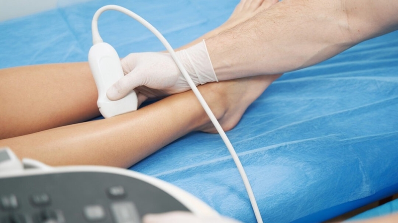 Siêu âm doppler mạch máu là gì? Có công dụng gì với sức khỏe? 1