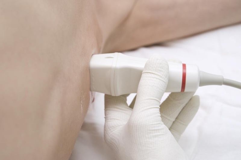 Siêu âm hạch nách và những điều cần biết 1