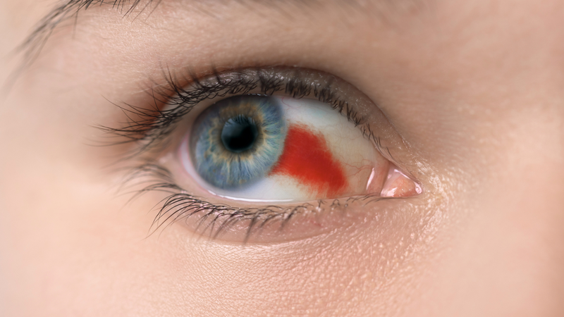 Siêu âm mắt là gì? Quy trình siêu âm cho mắt 3