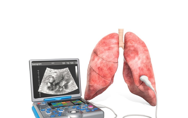 Siêu âm phổi: Công cụ hiệu quả trong đánh giá sức khỏe hô hấp 2