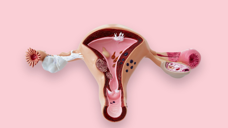 Siêu âm phụ khoa là gì? Mục đích của siêu âm phụ khoa 3