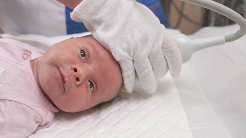 Siêu âm qua thóp ở trẻ em để làm gì?1