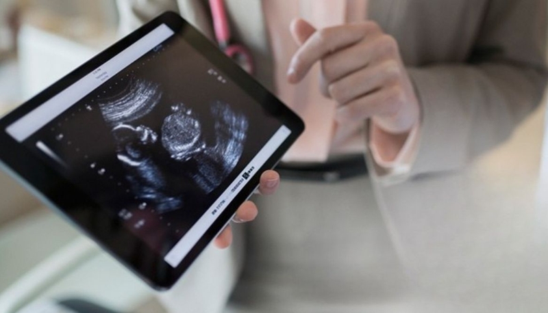 Siêu âm Soft Markers là gì? Siêu âm Soft Markers bao nhiêu tiền 3