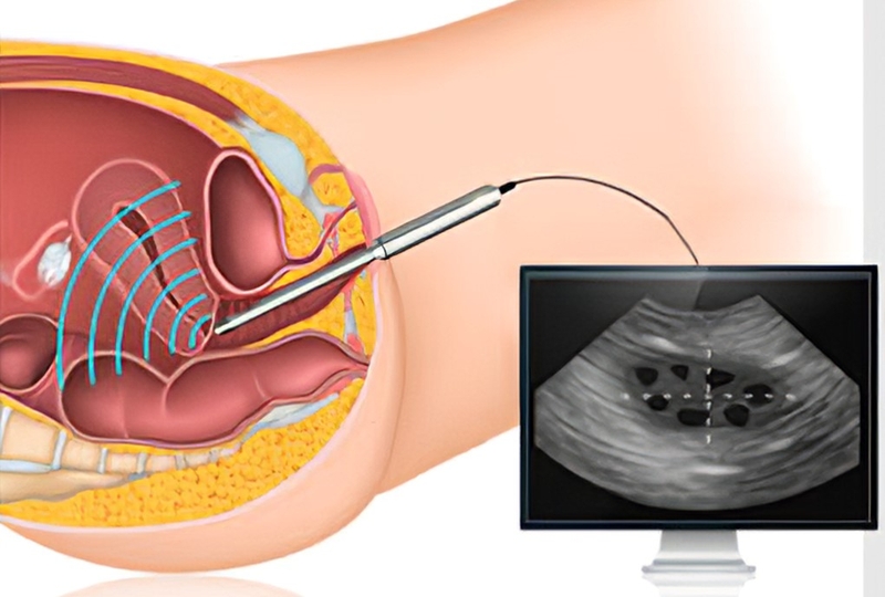 Siêu âm thai 8 tuần cho mẹ biết những gì? 3