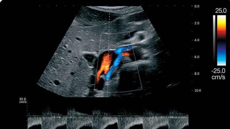 Siêu âm thai nhi: Thông tin từ A đến Z mà mẹ bỉm nên biết 2