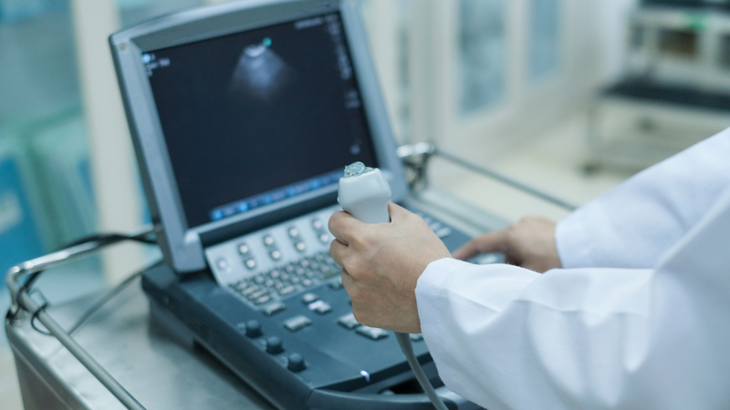 Siêu âm tim gắng sức và lưu ý khi thực hiện siêu âm tim gắng sức 1